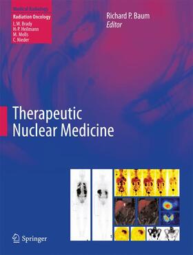 Baum |  Therapeutic Nuclear Medicine | Buch |  Sack Fachmedien