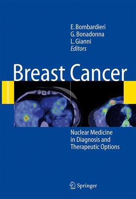 Bombardieri / Gianni / Bonadonna |  Breast Cancer | Buch |  Sack Fachmedien