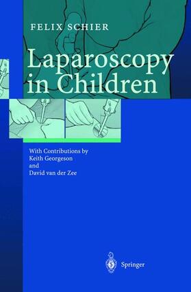 Schier |  Laparoscopy in Children | Buch |  Sack Fachmedien