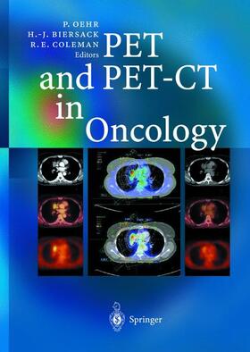 Oehr / Coleman / Biersack |  PET and PET-CT in Oncology | Buch |  Sack Fachmedien