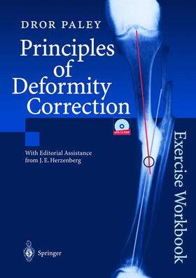 Paley |  Principles of Deformity Correction | Buch |  Sack Fachmedien