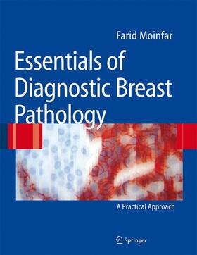 Moinfar |  Essentials of Diagnostic Breast Pathology | Buch |  Sack Fachmedien