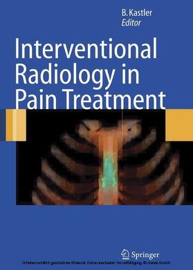 Kastler |  Interventional Radiology in Pain Treatment | eBook | Sack Fachmedien
