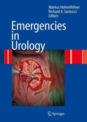 Santucci / Hohenfellner |  Emergencies in Urology | Buch |  Sack Fachmedien