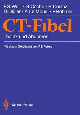 Weill / Coche / Le Mouel |  CT-Fibel | Buch |  Sack Fachmedien