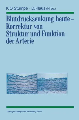 Klaus / Stumpe |  Blutdrucksenkung heute ¿ Korrektur von Struktur und Funktion der Arterie | Buch |  Sack Fachmedien