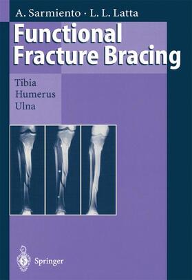 Latta / Sarmiento |  Functional Fracture Bracing | Buch |  Sack Fachmedien
