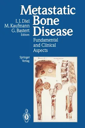 Diel / Kaufmann / Bastert |  Metastatic Bone Disease | Buch |  Sack Fachmedien