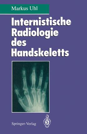 Uhl |  Internistische Radiologie des Handskeletts | Buch |  Sack Fachmedien