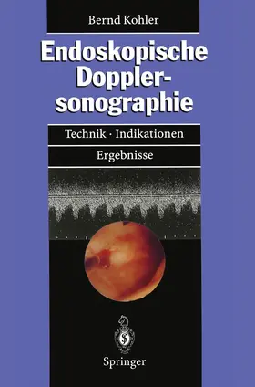 Kohler |  Endoskopische Dopplersonographie | Buch |  Sack Fachmedien