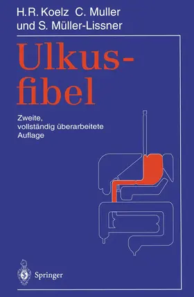 Koelz / Müller-Lissner / Muller |  Ulkusfibel | Buch |  Sack Fachmedien