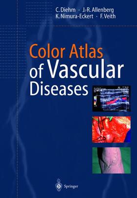 Diehm / Allenberg / Nimura-Eckert |  Color Atlas of Vascular Diseases | Buch |  Sack Fachmedien