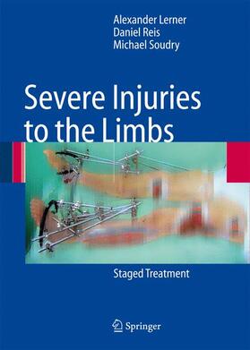 Lerner / Reis / Soudry |  Severe Injuries to the Limbs | Buch |  Sack Fachmedien