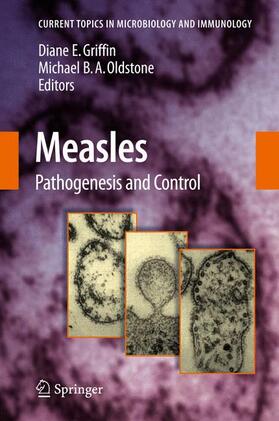 Oldstone / Griffin | Measles | Buch | 978-3-540-70616-8 | sack.de