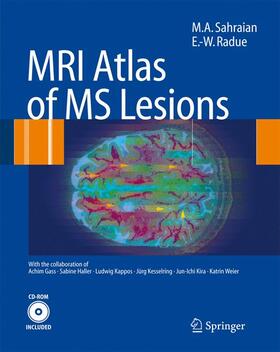 Sahraian / Radü |  MRI Atlas of MS Lesions | Buch |  Sack Fachmedien