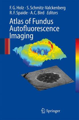 Holz / Schmitz-Valckenberg / Bird |  Atlas of Fundus Autofluorescence Imaging | Buch |  Sack Fachmedien