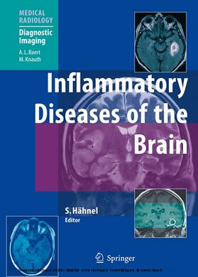 Hähnel |  Inflammatory Diseases of the Brain | eBook | Sack Fachmedien