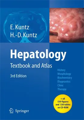 Kuntz |  Hepatology | Buch |  Sack Fachmedien