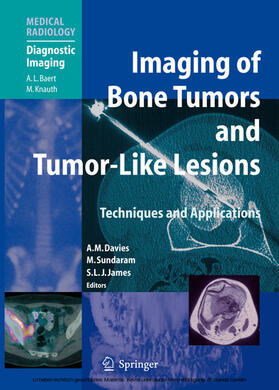 Davies / Sundaram / James |  Imaging of Bone Tumors and Tumor-Like Lesions | eBook | Sack Fachmedien