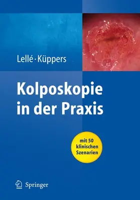 Lellé / Küppers |  Kolposkopie in der Praxis | Buch |  Sack Fachmedien