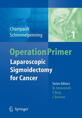 Champault / Schimmelpenning |  Laparoscopic Sigmoidectomy for Cancer | Buch |  Sack Fachmedien