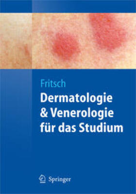 Fritsch |  Dermatologie und Venerologie für das Studium | eBook | Sack Fachmedien