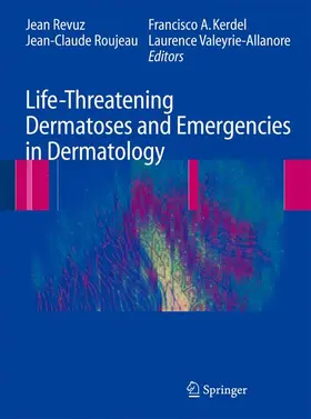 Revuz / Roujeau / Kerdel |  Life-Threatening Dermatoses and Emergencies in Dermatology | Buch |  Sack Fachmedien