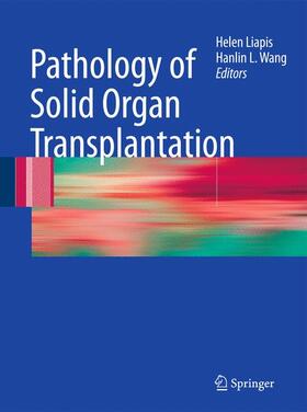 Liapis / Wang |  Pathology of Solid Organ Transplantation | Buch |  Sack Fachmedien