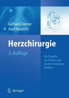 Haverich / Ziemer |  Herzchirurgie | Buch |  Sack Fachmedien
