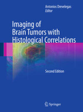 Drevelegas |  Imaging of Brain Tumors with Histological Correlations | Buch |  Sack Fachmedien