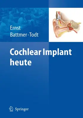 Ernst / Todt / Battmer |  Cochlear Implant heute | Buch |  Sack Fachmedien