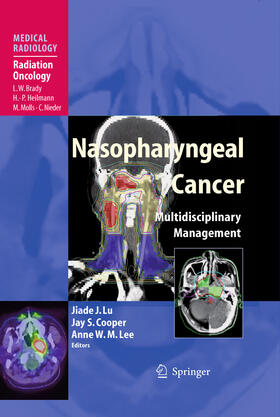 Lu / Cooper / Lee |  Nasopharyngeal Cancer | eBook | Sack Fachmedien