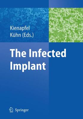 Kühn / Kienapfel |  The Infected Implant | Buch |  Sack Fachmedien