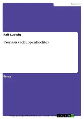 Ludwig |  Psoriasis (Schuppenflechte) | eBook | Sack Fachmedien