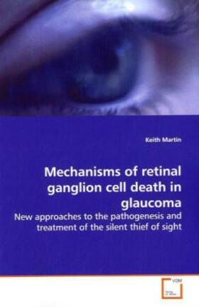 Martin |  Mechanisms of retinal ganglion cell death in glaucoma | Buch |  Sack Fachmedien