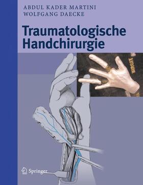 Martini / Daecke |  Traumatologische Handchirurgie | Buch |  Sack Fachmedien