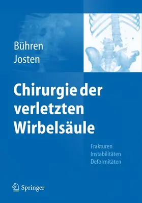 Josten / Bühren |  Chirurgie der verletzten Wirbelsäule | Buch |  Sack Fachmedien