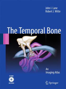 Lane / Witte |  Temporal Bone | Buch |  Sack Fachmedien