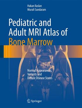 Sundaram / Ilaslan |  Pediatric and Adult MRI Atlas of Bone Marrow | Buch |  Sack Fachmedien