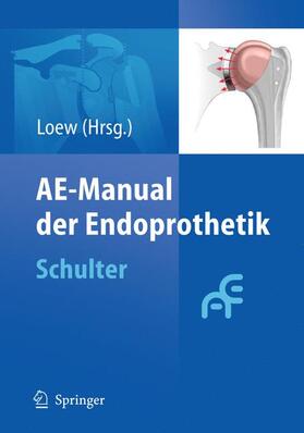 Loew |  AE-Manual der Endoprothetik | Buch |  Sack Fachmedien