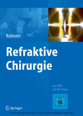 Kohnen |  Refraktive Chirurgie | eBook | Sack Fachmedien