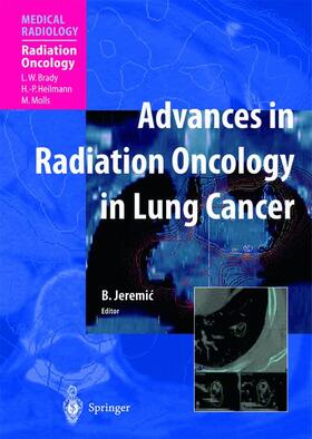 Jeremic |  Advances in Radiation Oncology in Lung Cancer | Buch |  Sack Fachmedien