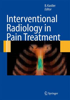 Kastler |  Interventional Radiology in Pain Treatment | Buch |  Sack Fachmedien