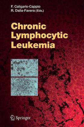  Chronic Lymphocytic Leukemia | Buch |  Sack Fachmedien