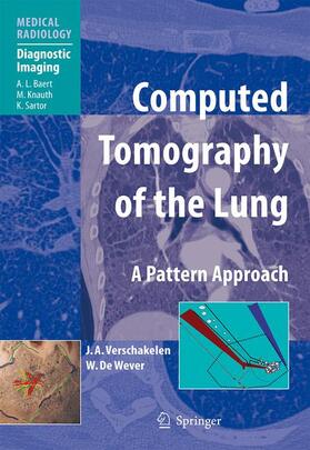 Verschakelen / de Wever |  Computed Tomography of the Lung | Buch |  Sack Fachmedien