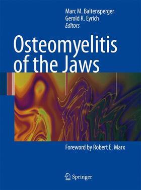 Baltensperger / Eyrich |  Osteomyelitis of the Jaws | Buch |  Sack Fachmedien