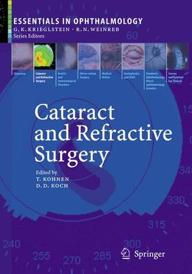 Koch / Kohnen |  Cataract and Refractive Surgery | Buch |  Sack Fachmedien