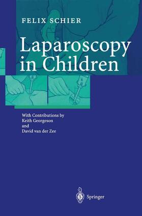 Schier |  Laparoscopy in Children | Buch |  Sack Fachmedien
