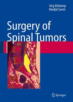 Samii / Klekamp |  Surgery of Spinal Tumors | Buch |  Sack Fachmedien