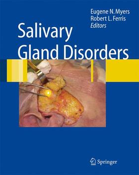 Ferris / Myers |  Salivary Gland Disorders | Buch |  Sack Fachmedien